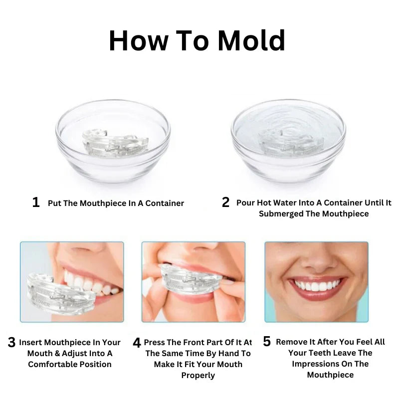 Snore-Free Mouthpiece