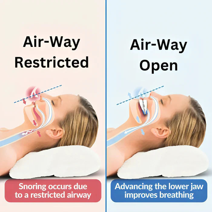 Snore-Free Mouthpiece